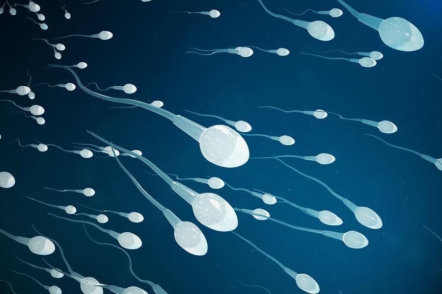 VARICOCEL AND FERTILITY: Natural treatment